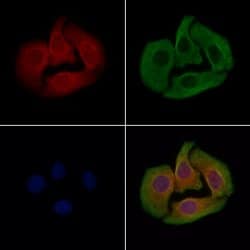 Invitrogen PP2C beta Polyclonal Antibody 100 &mu;L; Unconjugated:Antibodies,