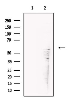 Invitrogen PP2C beta Polyclonal Antibody 100 &mu;L; Unconjugated:Antibodies,