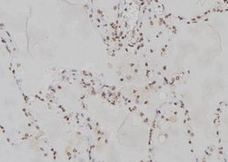 Invitrogen PPP2R2A Polyclonal Antibody 100 μL; Unconjugated:Antibodies,