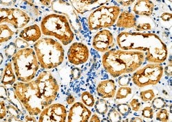 Invitrogen PPP2R2A Polyclonal Antibody 100 μL; Unconjugated:Antibodies,