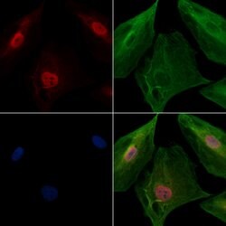 Invitrogen PPP2R5C Polyclonal Antibody 100 &mu;L; Unconjugated:Antibodies,