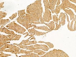 Invitrogen PR3 Polyclonal Antibody 100 &mu;L; Unconjugated:Antibodies,