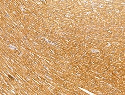 Invitrogen PR3 Polyclonal Antibody 100 &mu;L; Unconjugated:Antibodies,