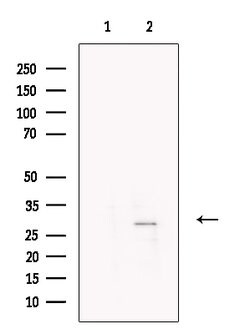 Invitrogen PR3 Polyclonal Antibody 100 &mu;L; Unconjugated:Antibodies,