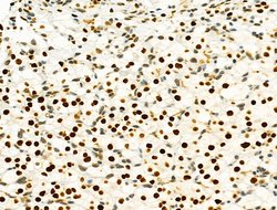 Invitrogen PRMT5 Polyclonal Antibody 100 &mu;L; Unconjugated:Antibodies,