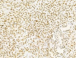 Invitrogen PRMT5 Polyclonal Antibody 100 &mu;L; Unconjugated:Antibodies,