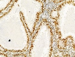 Invitrogen PRMT5 Polyclonal Antibody 100 &mu;L; Unconjugated:Antibodies,
