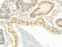 Invitrogen PRMT5 Polyclonal Antibody 100 &mu;L; Unconjugated:Antibodies,