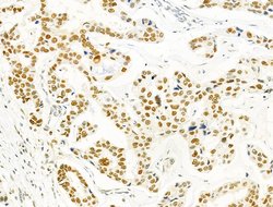 Invitrogen PRMT5 Polyclonal Antibody 100 &mu;L; Unconjugated:Antibodies,