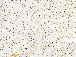 Invitrogen PRMT5 Polyclonal Antibody 100 &mu;L; Unconjugated:Antibodies,