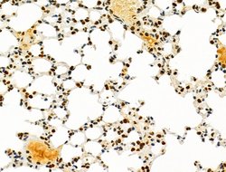 Invitrogen PRMT5 Polyclonal Antibody 100 &mu;L; Unconjugated:Antibodies,