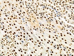 Invitrogen PRMT5 Polyclonal Antibody 100 &mu;L; Unconjugated:Antibodies,