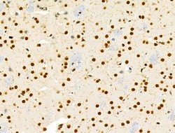 Invitrogen PRMT5 Polyclonal Antibody 100 &mu;L; Unconjugated:Antibodies,