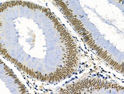 Invitrogen PRMT5 Polyclonal Antibody 100 &mu;L; Unconjugated:Antibodies,