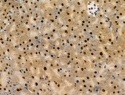 Invitrogen PRMT5 Polyclonal Antibody 100 &mu;L; Unconjugated:Antibodies,