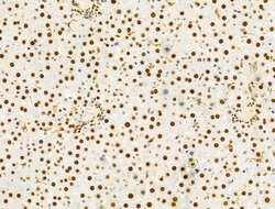 Invitrogen PRMT5 Polyclonal Antibody 100 &mu;L; Unconjugated:Antibodies,