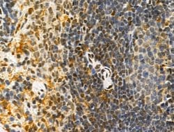 Invitrogen PRMT5 Polyclonal Antibody 100 &mu;L; Unconjugated:Antibodies,