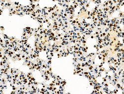 Invitrogen PRMT5 Polyclonal Antibody 100 &mu;L; Unconjugated:Antibodies,
