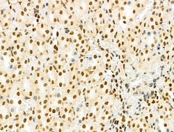 Invitrogen PRMT5 Polyclonal Antibody 100 &mu;L; Unconjugated:Antibodies,