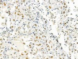 Invitrogen PRMT5 Polyclonal Antibody 100 &mu;L; Unconjugated:Antibodies,