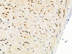 Invitrogen PRMT5 Polyclonal Antibody 100 &mu;L; Unconjugated:Antibodies,