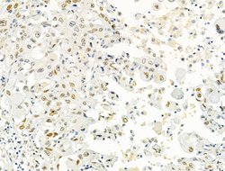 Invitrogen PRMT5 Polyclonal Antibody 100 &mu;L; Unconjugated:Antibodies,