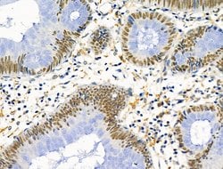 Invitrogen PRMT5 Polyclonal Antibody 100 &mu;L; Unconjugated:Antibodies,