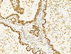 Invitrogen PRMT5 Polyclonal Antibody 100 &mu;L; Unconjugated:Antibodies,