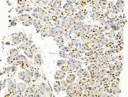 Invitrogen PRMT5 Polyclonal Antibody 100 &mu;L; Unconjugated:Antibodies,