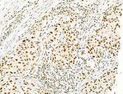 Invitrogen PRMT5 Polyclonal Antibody 100 &mu;L; Unconjugated:Antibodies,