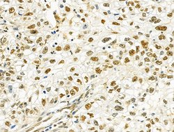 Invitrogen PRMT5 Polyclonal Antibody 100 &mu;L; Unconjugated:Antibodies,