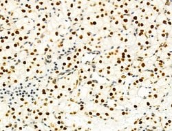 Invitrogen PRMT5 Polyclonal Antibody 100 &mu;L; Unconjugated:Antibodies,