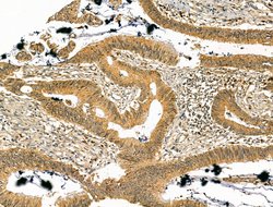 Invitrogen PREP Polyclonal Antibody 100 &mu;L; Unconjugated:Antibodies,
