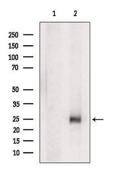 Invitrogen PSCA Polyclonal Antibody 100 &mu;L; Unconjugated:Antibodies,