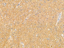 Invitrogen PRRG4 Polyclonal Antibody 100 &mu;L; Unconjugated:Antibodies,