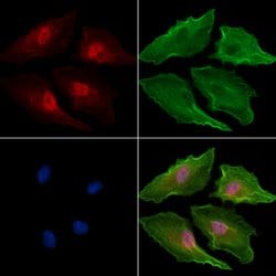 Invitrogen PSMA4 Polyclonal Antibody 100 &mu;L; Unconjugated:Antibodies,