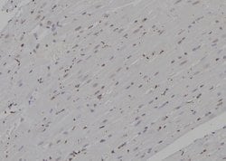 Invitrogen PSMA4 Polyclonal Antibody 100 &mu;L; Unconjugated:Antibodies,