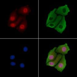 Invitrogen PSMA7 Polyclonal Antibody 100 &mu;L; Unconjugated:Antibodies,