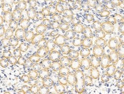 PTCH2 Polyclonal Antibody:Antibodies, Polyclonal