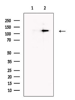 PTCH2 Polyclonal Antibody:Antibodies, Polyclonal