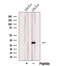 Invitrogen PTGES2 Polyclonal Antibody 100 &mu;L; Unconjugated:Antibodies,
