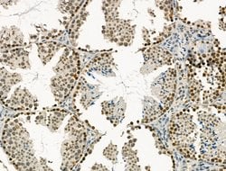 Invitrogen PU.1 Polyclonal Antibody 100 &mu;L; Unconjugated:Antibodies,