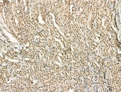 Invitrogen PU.1 Polyclonal Antibody 100 &mu;L; Unconjugated:Antibodies,