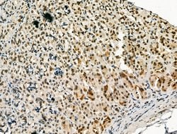 Invitrogen PU.1 Polyclonal Antibody 100 &mu;L; Unconjugated:Antibodies,