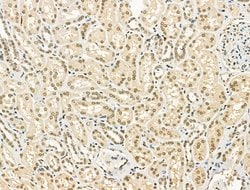 Invitrogen PU.1 Polyclonal Antibody 100 &mu;L; Unconjugated:Antibodies,