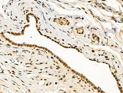 Invitrogen PU.1 Polyclonal Antibody 100 &mu;L; Unconjugated:Antibodies,
