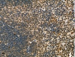 Invitrogen PU.1 Polyclonal Antibody 100 &mu;L; Unconjugated:Antibodies,