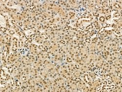 Invitrogen PU.1 Polyclonal Antibody 100 &mu;L; Unconjugated:Antibodies,