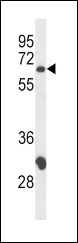 Invitrogen CD4 Polyclonal Antibody 400 &mu;L | Buy Online | Invitrogen&trade; | Fisher Scientific