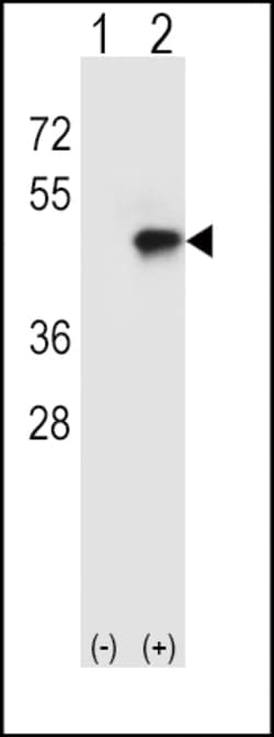 Invitrogen CD4 Polyclonal Antibody 400 &mu;L | Buy Online | Invitrogen&trade; | Fisher Scientific